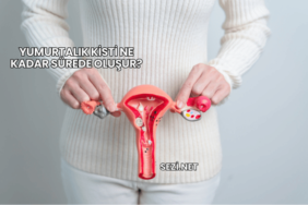 Yumurtalık Kisti Ne Kadar Sürede Oluşur?